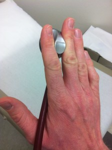 the right way to hold a stethoscope